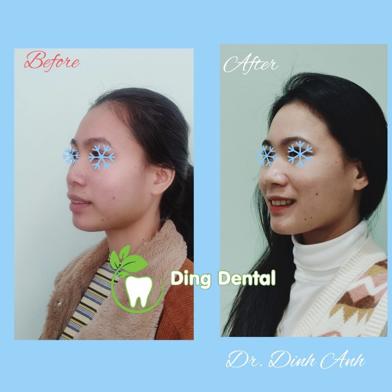 473777691 1163607015774488 4504416761763287745 n 768x768