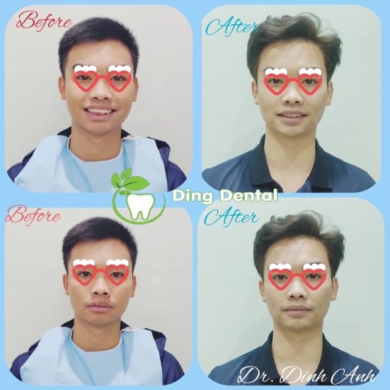 473819046 1163603299108193 4169957018352094253 n 768x768