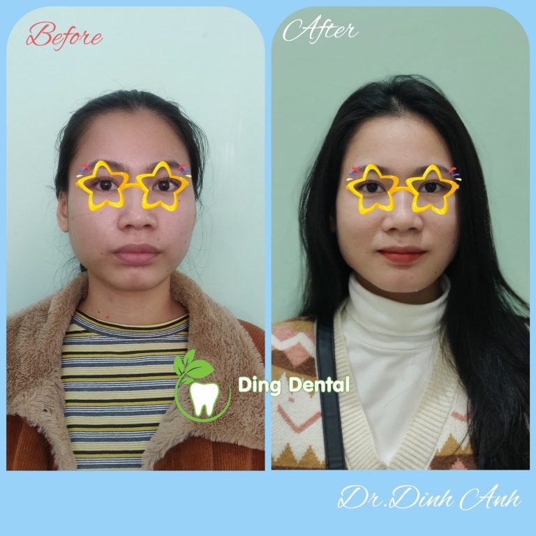 473832080 1163607012441155 8252347806054559994 n 768x768